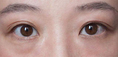 ����Ƥ����ʲôԭ�� ��Ƥ���������